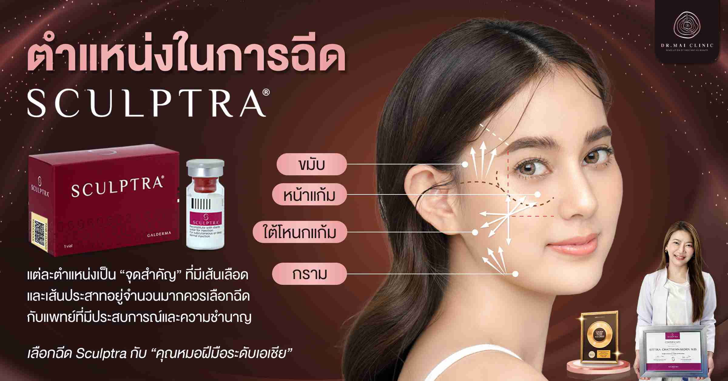 จุดสำคัญในการฉีด Sculptra