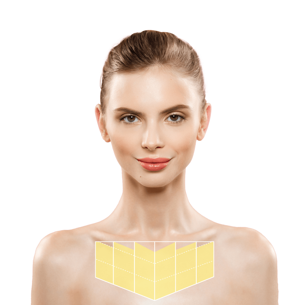 Ulthera Prime เชียงใหม่