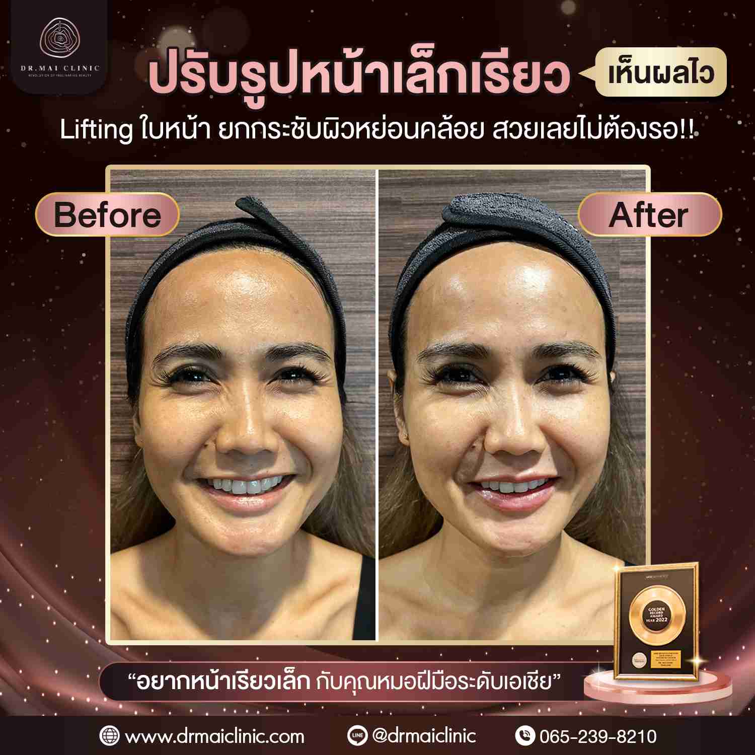 งานที่-10-08-66