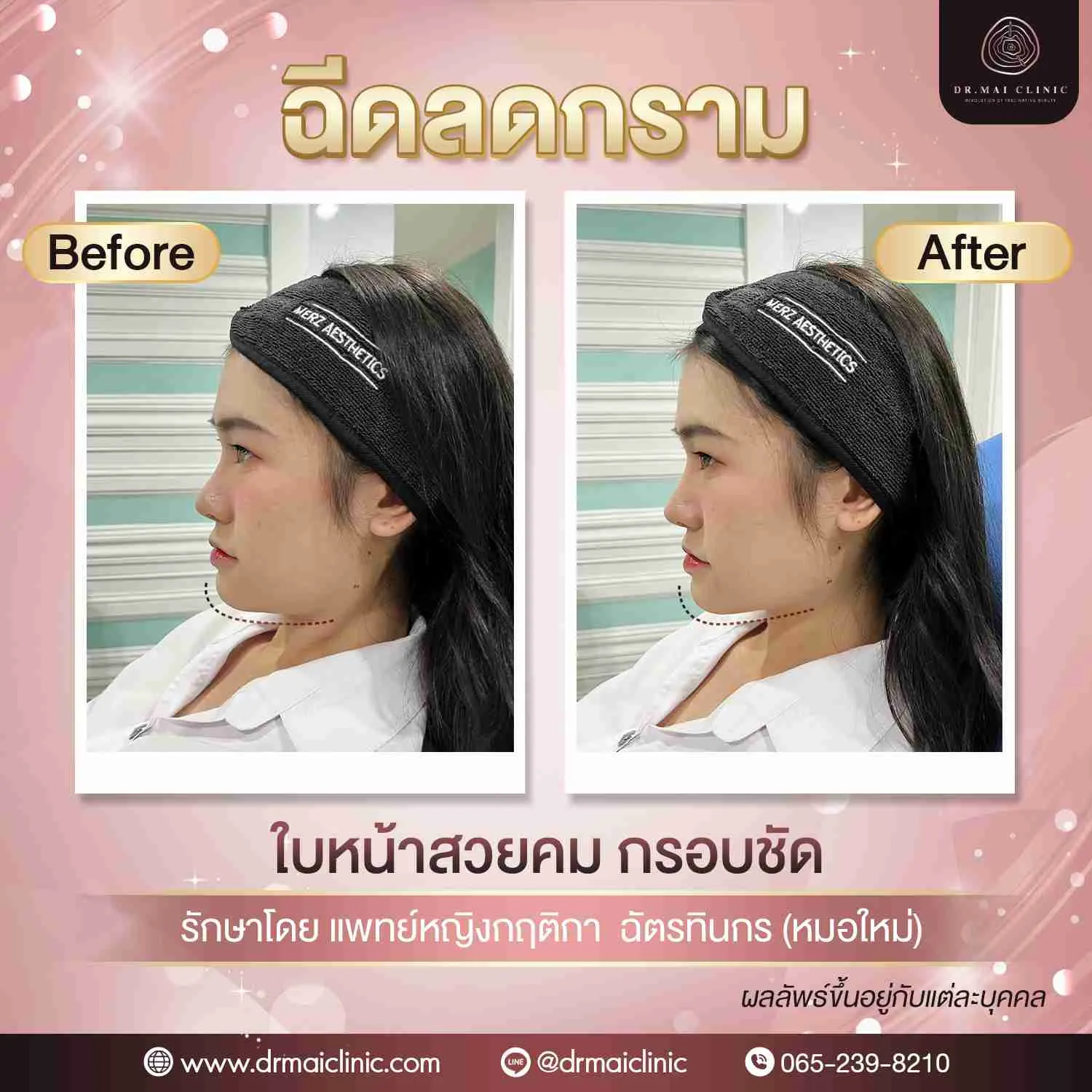 งานที่-22